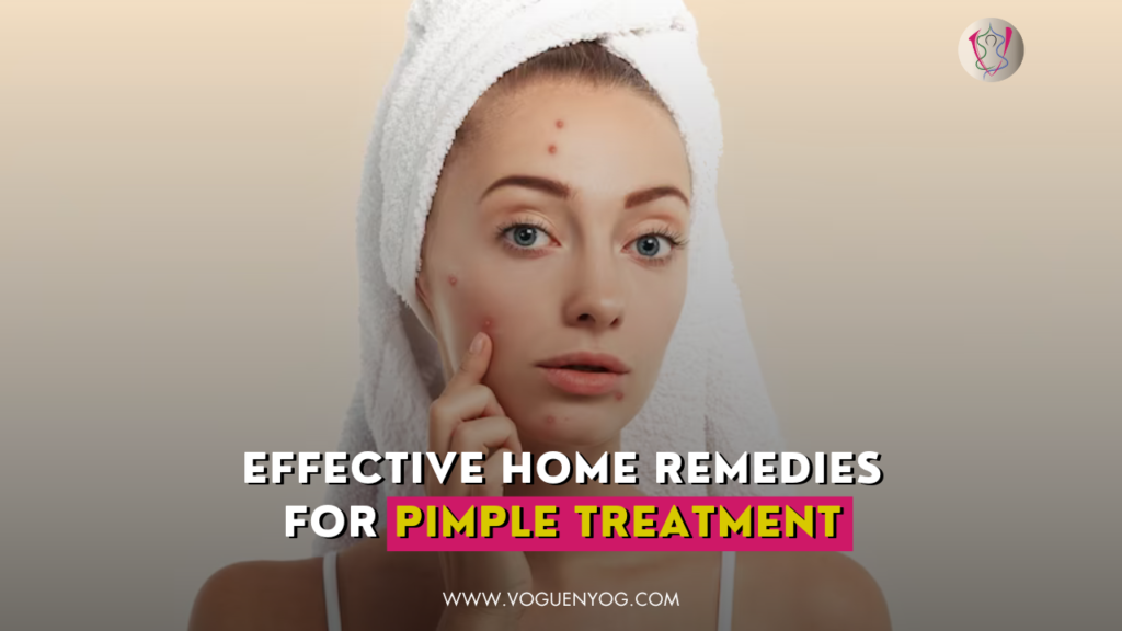 Effective-Home-Remedies-for-Pimple-Treatment